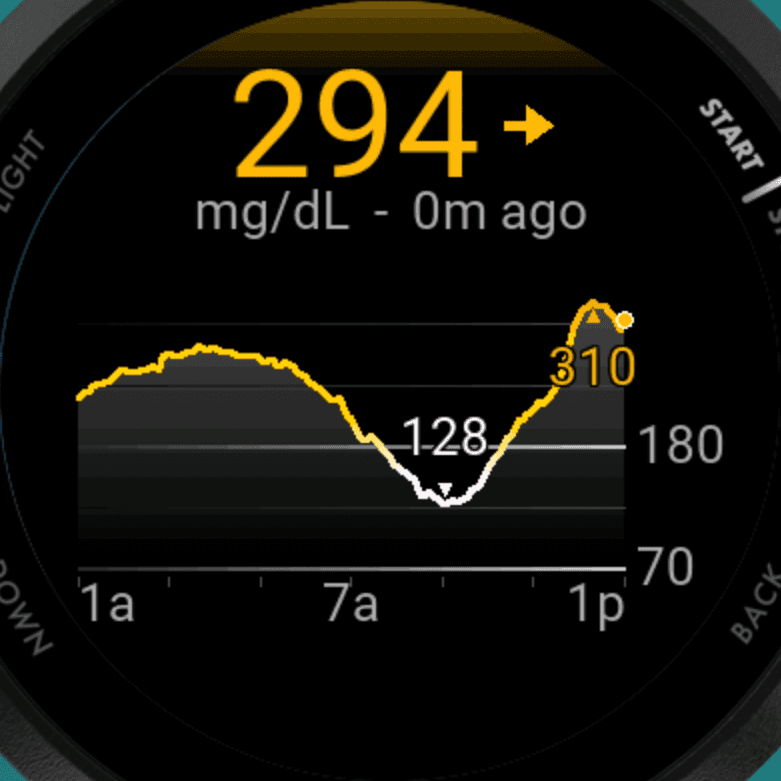 The GGlance app showing the day's glucose trend graph